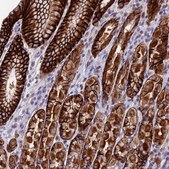 Anti-PUS10 antibody produced in rabbit Prestige Antibodies&#174; Powered by Atlas Antibodies, affinity isolated antibody, buffered aqueous glycerol solution