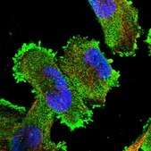 Anti-XRN1 antibody produced in rabbit Prestige Antibodies&#174; Powered by Atlas Antibodies, affinity isolated antibody, buffered aqueous glycerol solution