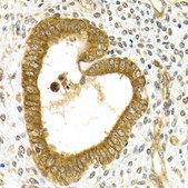 Anti-RAB27A antibody produced in rabbit