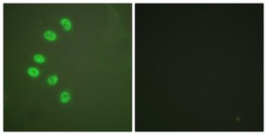 Anti-Progesterone Receptor antibody produced in rabbit affinity isolated antibody