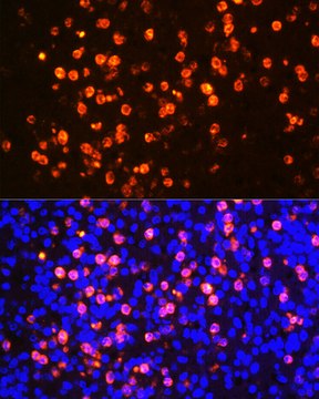 Anti-Proteinase 3/PR3 Antibody, clone 3I3M1, Rabbit Monoclonal