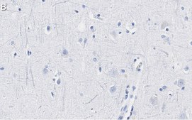 Anti-Neurofilament H Antibody, clone 2N19 ZooMAb&#174; Rabbit Monoclonal recombinant, expressed in HEK 293 cells