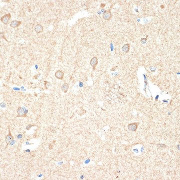 Anti-Guanylyl Cyclase beta 1 (GUCY1B3) antibody produced in rabbit