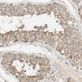 Anti-USP2 antibody produced in rabbit Prestige Antibodies&#174; Powered by Atlas Antibodies, affinity isolated antibody, buffered aqueous glycerol solution