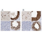 Anti-RCN2 antibody produced in rabbit Prestige Antibodies&#174; Powered by Atlas Antibodies, affinity isolated antibody, buffered aqueous glycerol solution