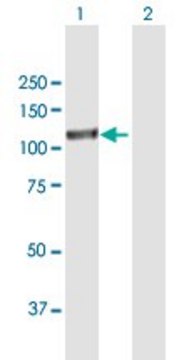 Anti-EPAS1 antibody produced in mouse purified immunoglobulin, buffered aqueous solution
