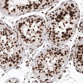 Monoclonal Anti-H2AFX antibody produced in mouse Prestige Antibodies&#174; Powered by Atlas Antibodies, clone CL5157, purified immunoglobulin, buffered aqueous glycerol solution