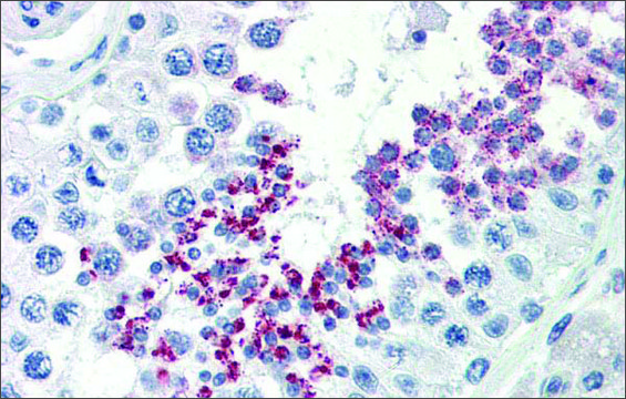 Anti-KLB affinity isolated antibody