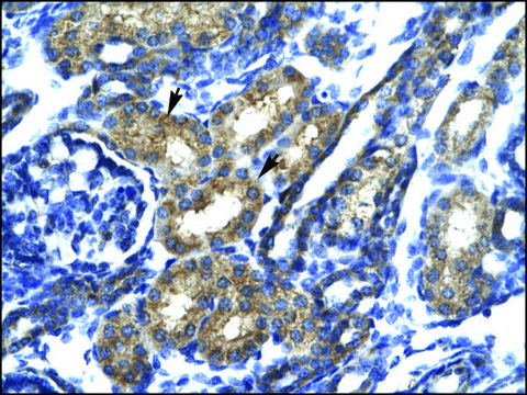 Anti-SP140 antibody produced in rabbit IgG fraction of antiserum