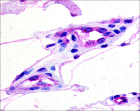 Anti-GPR21 (AB2) antibody produced in rabbit affinity isolated antibody, buffered aqueous solution