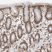 Anti-ZNF384 antibody produced in rabbit Prestige Antibodies&#174; Powered by Atlas Antibodies, affinity isolated antibody, buffered aqueous glycerol solution