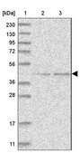 Anti-GTDC1 antibody produced in rabbit Prestige Antibodies&#174; Powered by Atlas Antibodies, affinity isolated antibody, buffered aqueous glycerol solution