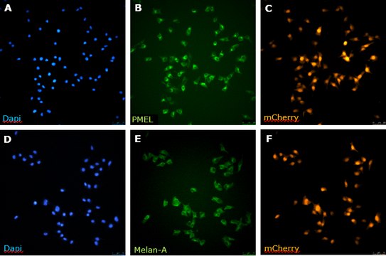 BT-RMS Brain-tropic RET Melanoma-sorted Mouse Cell Line