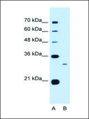 Anti-C1QB antibody produced in rabbit affinity isolated antibody