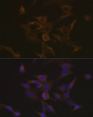 Anti-EB3/MAPRE3 antibody produced in rabbit
