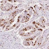 Monoclonal Anti-ANLN antibody produced in mouse Prestige Antibodies&#174; Powered by Atlas Antibodies, clone CL0303, purified immunoglobulin, buffered aqueous glycerol solution