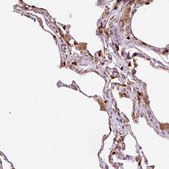 Anti-CD83 antibody produced in rabbit Prestige Antibodies&#174; Powered by Atlas Antibodies, affinity isolated antibody, buffered aqueous glycerol solution