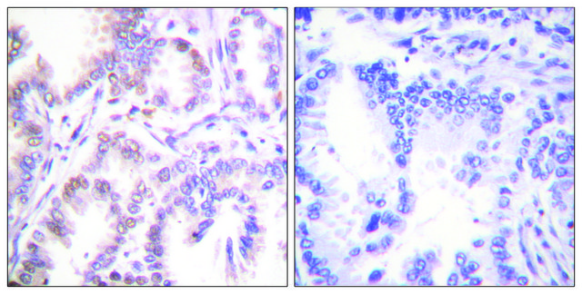 Anti-CDK7 antibody produced in rabbit affinity isolated antibody