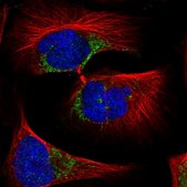 Anti-SLC11A2 antibody produced in rabbit Prestige Antibodies&#174; Powered by Atlas Antibodies, affinity isolated antibody, buffered aqueous glycerol solution