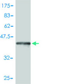 Monoclonal Anti-COMT antibody produced in mouse clone 1G4-1A1, purified immunoglobulin, buffered aqueous solution