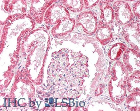 Anti-ORP5 (OBPH1) antibody produced in goat affinity isolated antibody, buffered aqueous solution