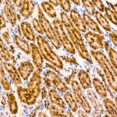 Anti-ALKBH1 Antibody, clone 5K4W5, Rabbit Monoclonal