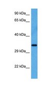 Anti-KLF6 affinity isolated antibody