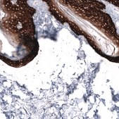 Monoclonal Anti-Krt14 Antibody Produced In Mouse Prestige Antibodies&#174; Powered by Atlas Antibodies, clone CL14565, affinity isolated antibody, buffered aqueous glycerol solution