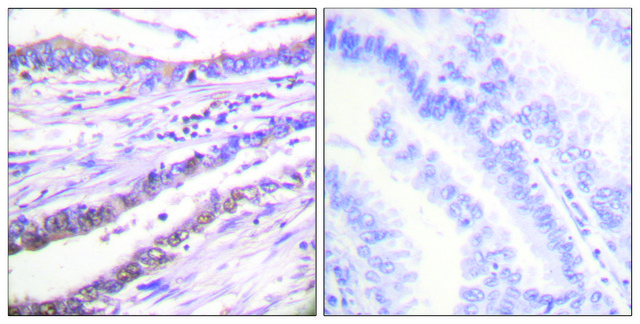 Anti-Cyclin A antibody produced in rabbit affinity isolated antibody