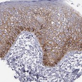 Anti-CDH3 antibody produced in rabbit Prestige Antibodies&#174; Powered by Atlas Antibodies, affinity isolated antibody, buffered aqueous glycerol solution