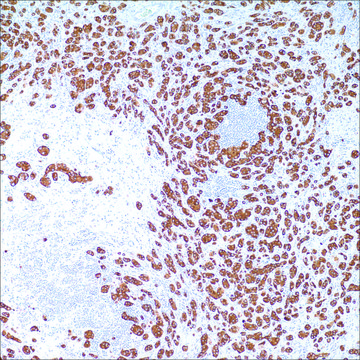 Cytokeratin (35betaH11) Mouse Monoclonal Antibody