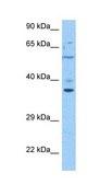 Anti-TMEM173 antibody produced in rabbit affinity isolated antibody