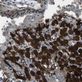 Anti-PDLIM1 antibody produced in rabbit Prestige Antibodies&#174; Powered by Atlas Antibodies, affinity isolated antibody, buffered aqueous glycerol solution