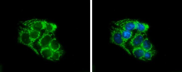 Anti-SLC25A1 antibody produced in rabbit affinity isolated antibody, buffered aqueous solution