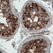 Monoclonal Anti-DIAPH2 antibody produced in mouse Prestige Antibodies&#174; Powered by Atlas Antibodies, clone CL1113, purified immunoglobulin, buffered aqueous glycerol solution