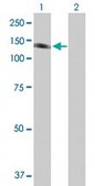 Anti-PTK2B antibody produced in mouse purified immunoglobulin, buffered aqueous solution