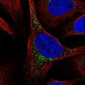 Anti-SCCPDH antibody produced in rabbit Prestige Antibodies&#174; Powered by Atlas Antibodies, affinity isolated antibody, buffered aqueous glycerol solution