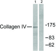 Anti-Collagen IV antibody produced in rabbit affinity isolated antibody