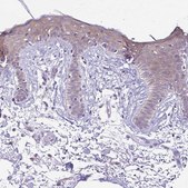 Anti-DSP antibody produced in rabbit Prestige Antibodies&#174; Powered by Atlas Antibodies, affinity isolated antibody, buffered aqueous glycerol solution