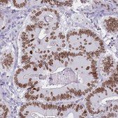 Monoclonal Anti-SATB2 antibody produced in mouse Prestige Antibodies&#174; Powered by Atlas Antibodies, clone CL0276, purified immunoglobulin, buffered aqueous glycerol solution