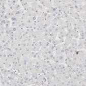Anti-RTN3 antibody produced in rabbit Prestige Antibodies&#174; Powered by Atlas Antibodies, affinity isolated antibody, buffered aqueous glycerol solution