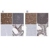 Anti-SEPT7 antibody produced in rabbit Prestige Antibodies&#174; Powered by Atlas Antibodies, affinity isolated antibody, buffered aqueous glycerol solution, ab1