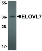 Anti-ELOVL7 antibody produced in rabbit affinity isolated antibody, buffered aqueous solution