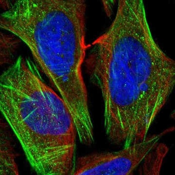 Anti-CSGALNACT1 antibody produced in rabbit Prestige Antibodies&#174; Powered by Atlas Antibodies, affinity isolated antibody