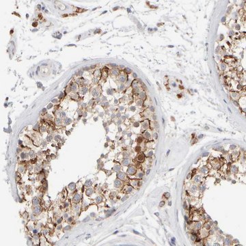 Anti-ZNF112 antibody produced in rabbit Prestige Antibodies&#174; Powered by Atlas Antibodies, affinity isolated antibody, buffered aqueous glycerol solution