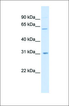 Anti-CHST2 antibody produced in rabbit affinity isolated antibody