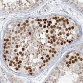 Anti-SCML1 antibody produced in rabbit Prestige Antibodies&#174; Powered by Atlas Antibodies, affinity isolated antibody, buffered aqueous glycerol solution