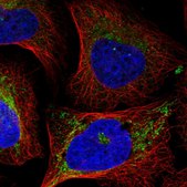 Anti-EIF2A antibody produced in rabbit Prestige Antibodies&#174; Powered by Atlas Antibodies, affinity isolated antibody, buffered aqueous glycerol solution