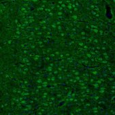Anti-ARHGAP1 antibody produced in rabbit Prestige Antibodies&#174; Powered by Atlas Antibodies, affinity isolated antibody, buffered aqueous glycerol solution