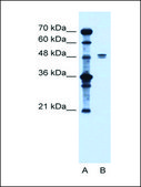 Anti-SLC39A6 antibody produced in rabbit IgG fraction of antiserum